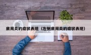 肩周炎的症状表现（左侧肩周炎的症状表现）