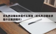 舌头两边锯齿状是什么原因（舌头两边锯齿状是什么原因图片）