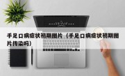 手足口病症状初期图片（手足口病症状初期图片传染吗）