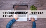 如何分辨黑色素瘤和普通痣？（如何区别黑色素瘤和痣?）