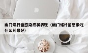 幽门螺杆菌感染症状表现（幽门螺杆菌感染吃什么药最好）